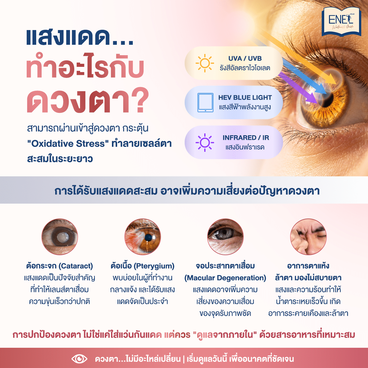 แสงแดด…ส่งผลต่อดวงตาอย่างไร